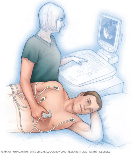 Echocardiography